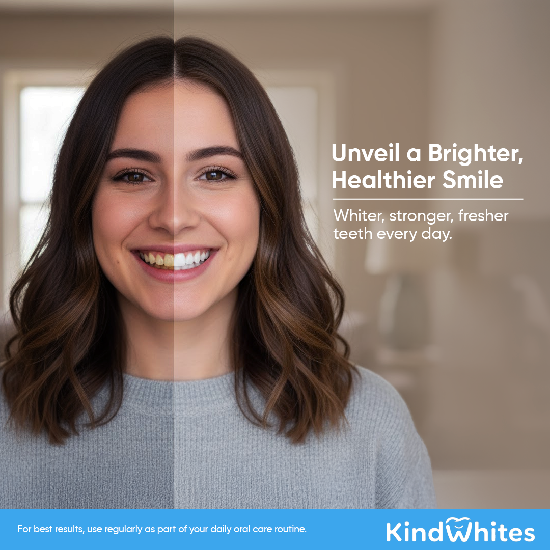 KindWhites Teeth Whitening Powder